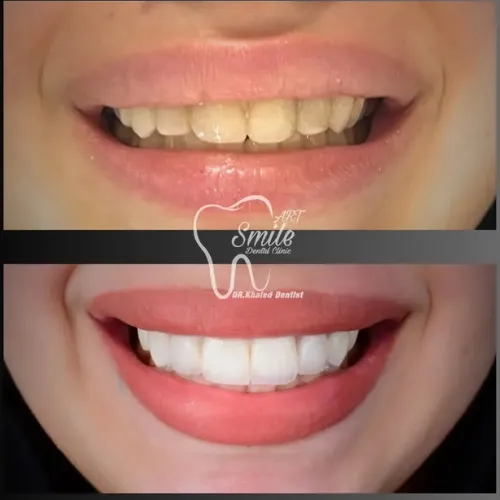 Before & After - Case 3