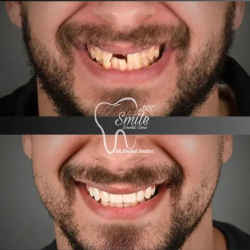 Before & After - Case 2