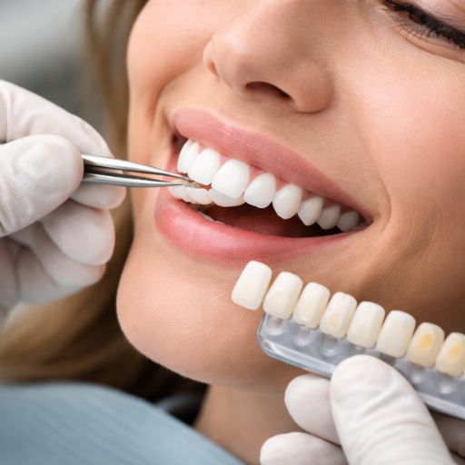 تحسين شكل الابتسامة