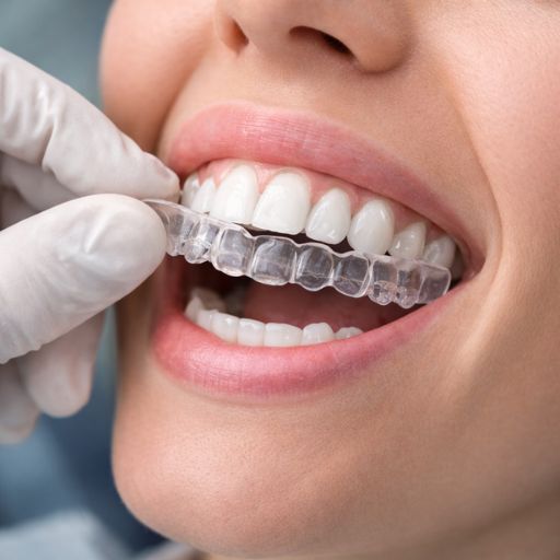 ترتيب الأسنان